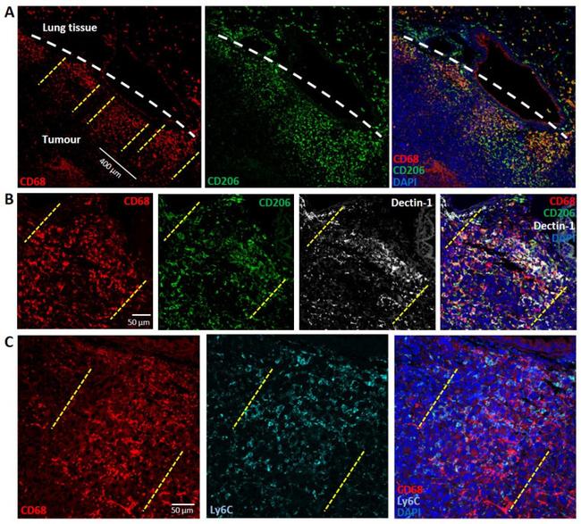 Dectin 1 (soluble) Antibody in Immunohistochemistry (IHC)