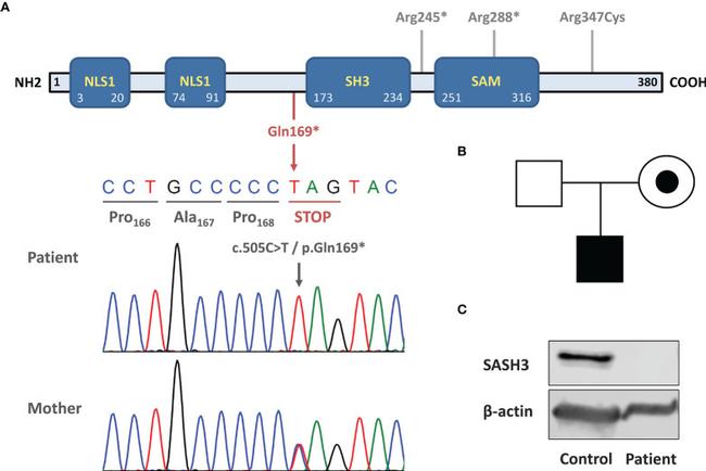 SASH3 Antibody in Western Blot (WB)