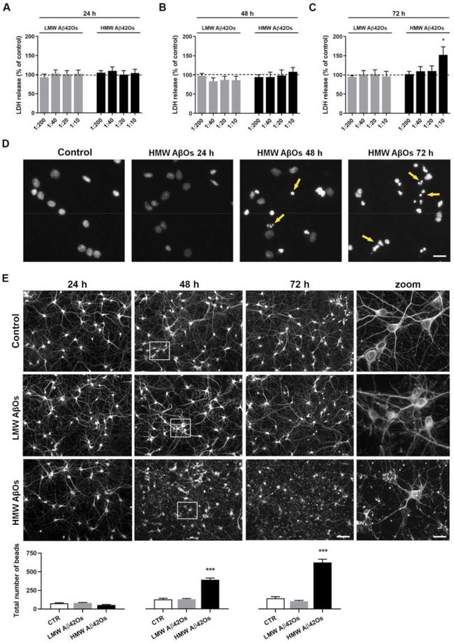 beta-3 Tubulin Antibody in Immunocytochemistry (ICC/IF)