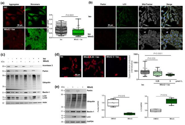 Parkin Antibody in Western Blot (WB)