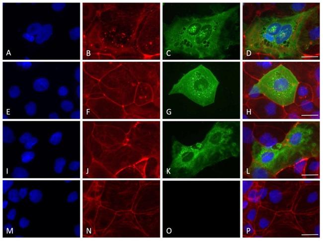 SARS/SARS-CoV-2 Nucleocapsid Antibody in Immunocytochemistry (ICC/IF)