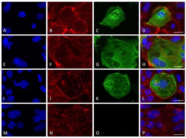 SARS/SARS-CoV-2 Nucleocapsid Antibody in Immunocytochemistry (ICC/IF)