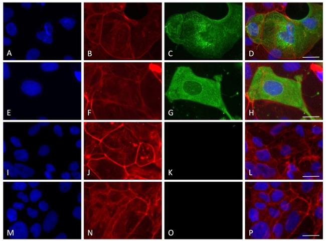 SARS/SARS-CoV-2 Nucleocapsid Antibody in Immunocytochemistry (ICC/IF)