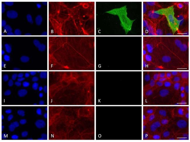 SARS/SARS-CoV-2 Nucleocapsid Antibody in Immunocytochemistry (ICC/IF)