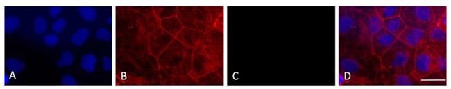 SARS/SARS-CoV-2 Nucleocapsid Antibody in Immunocytochemistry (ICC/IF)