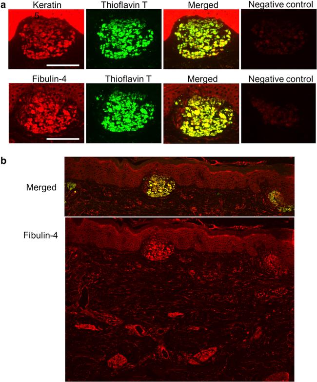 Cytokeratin 5 Antibody in Immunohistochemistry (IHC)