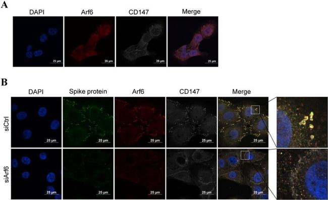 ARF6 Antibody in Immunocytochemistry (ICC/IF)