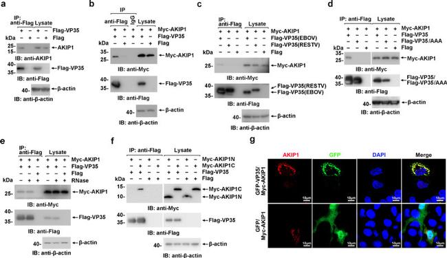 AKIP1 Antibody in Immunocytochemistry (ICC/IF)