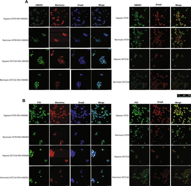 p53 Antibody in Immunocytochemistry (ICC/IF)