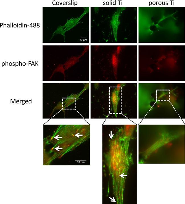 Phospho-FAK (Tyr397) Antibody in Immunocytochemistry (ICC/IF)