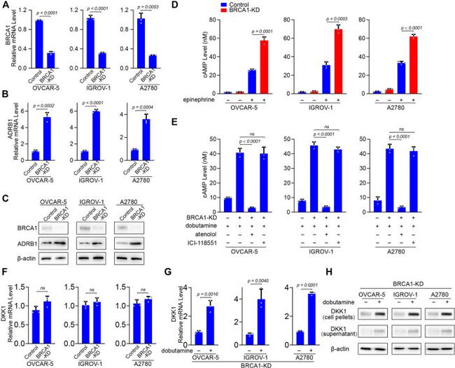 BRCA1 Antibody in Western Blot (WB)