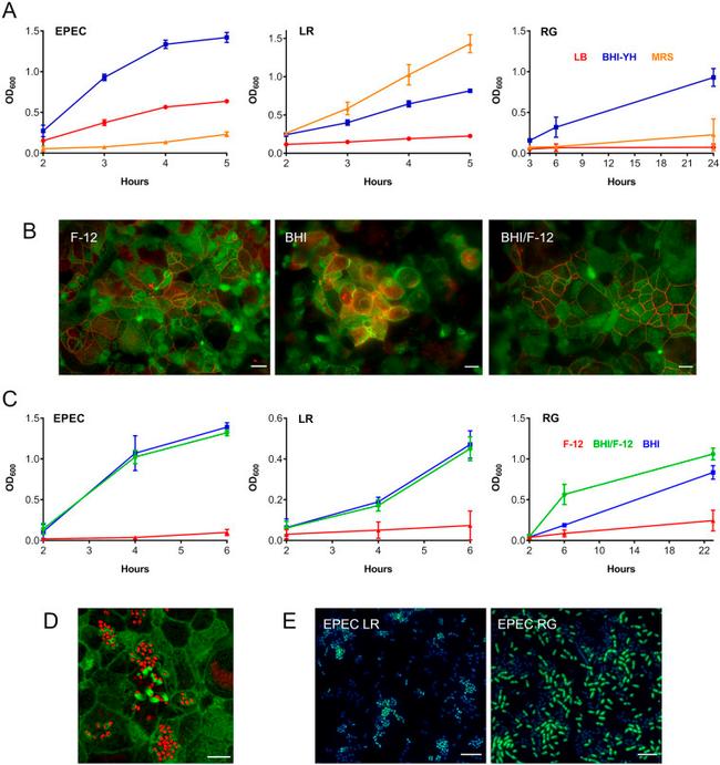 Occludin Antibody in Immunocytochemistry (ICC/IF)