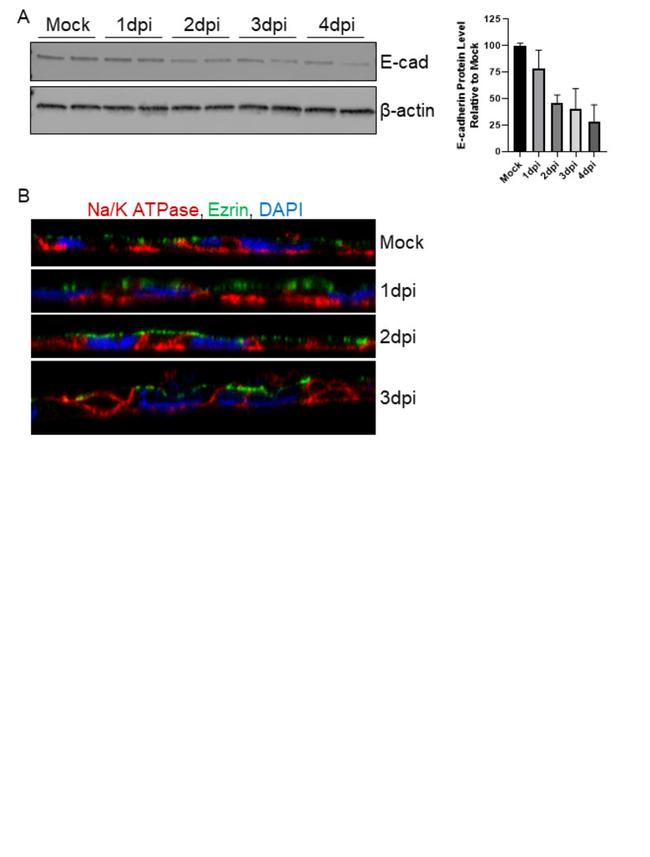 Ezrin Antibody in Immunocytochemistry (ICC/IF)