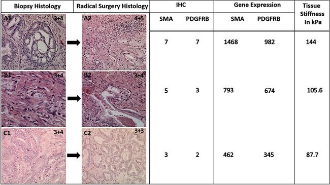 CD140b (PDGFRB) Antibody in Immunohistochemistry (IHC)