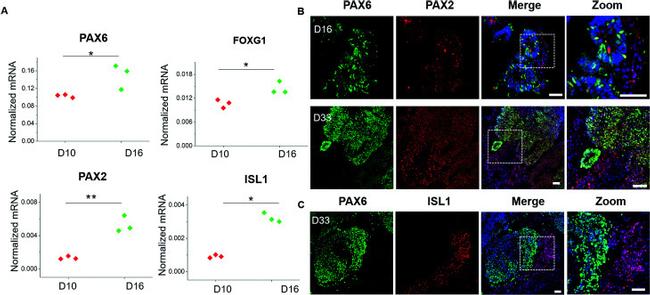 ISL1 Antibody in Immunohistochemistry (IHC)