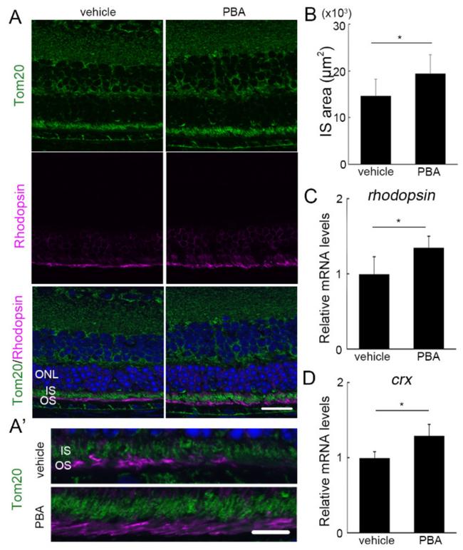 Rhodopsin Antibody in Immunohistochemistry (Paraffin) (IHC (P))