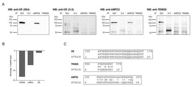 TRIM28 Antibody in Western Blot (WB)