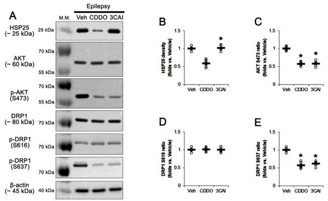 DNM1L Antibody in Western Blot (WB)