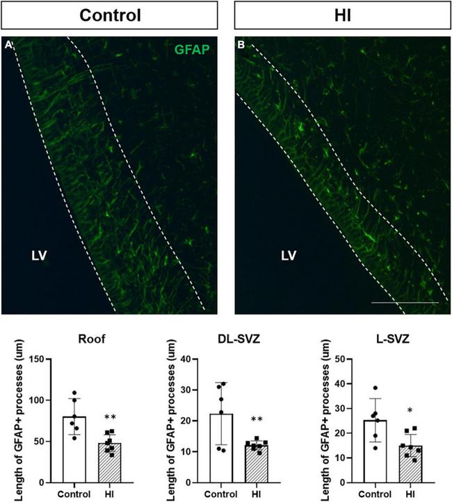 GFAP Antibody in Immunohistochemistry (IHC)