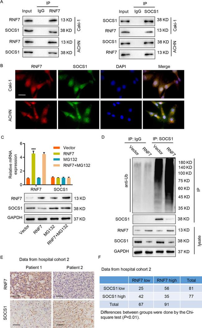 SOCS1 Antibody in Western Blot, Immunoprecipitation (WB, IP)