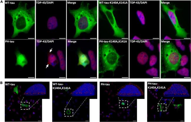 TDP-43 Antibody in Immunocytochemistry (ICC/IF)