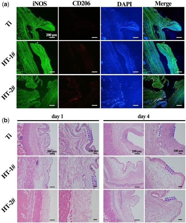 iNOS Antibody in Immunohistochemistry (IHC)