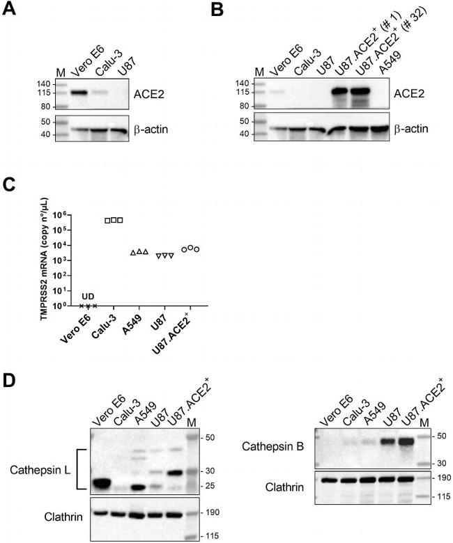 Cathepsin L Antibody in Western Blot (WB)