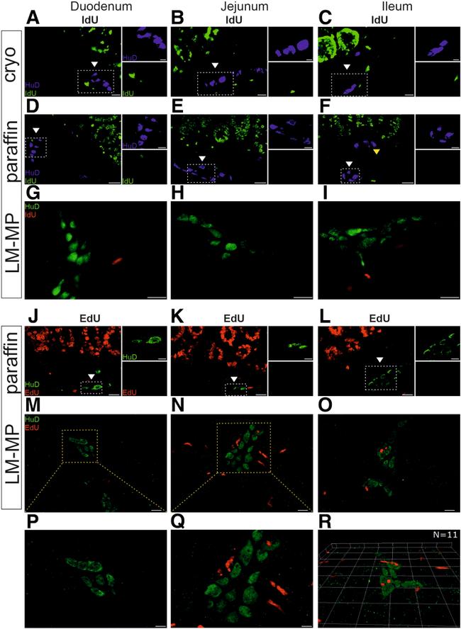 HuD Antibody in Immunohistochemistry (Frozen), Immunohistochemistry (Paraffin) (IHC (F), IHC (P))