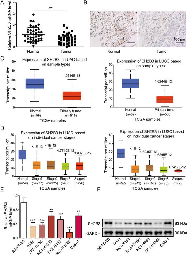 LNK Antibody in Immunohistochemistry (IHC)