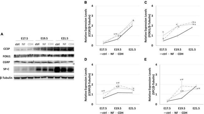 FOXJ1 Antibody in Western Blot (WB)