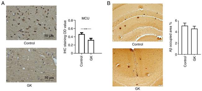 MCU Antibody in Immunohistochemistry (IHC)