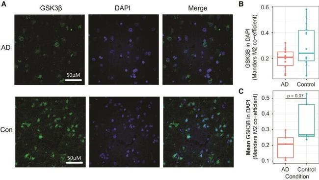 GSK3B Antibody in Immunohistochemistry (IHC)