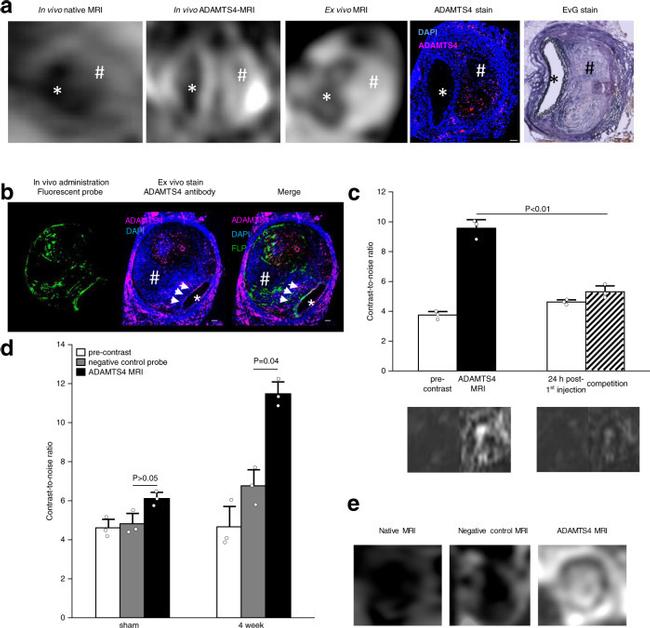 ADAMTS4 Antibody in Immunohistochemistry (IHC)