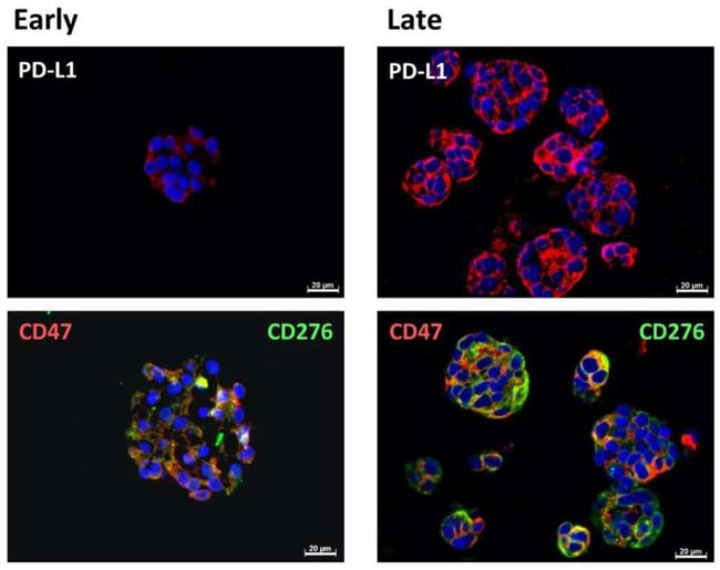 CD274 (PD-L1, B7-H1) Antibody in Immunohistochemistry (Paraffin) (IHC (P))