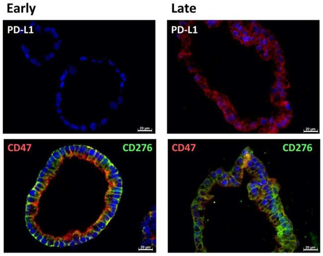 CD47 Antibody in Immunohistochemistry (Paraffin) (IHC (P))