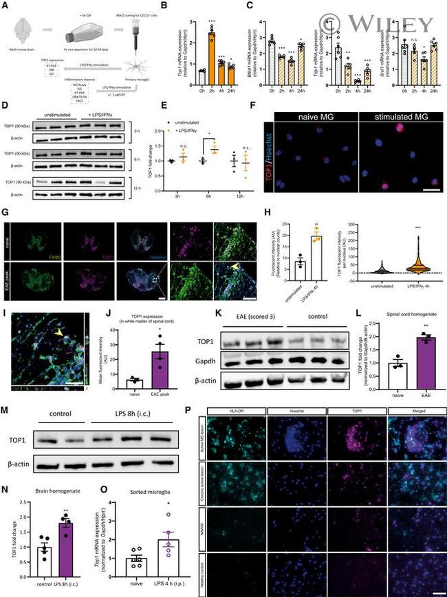 TOP1 Antibody in Immunohistochemistry (Paraffin) (IHC (P))