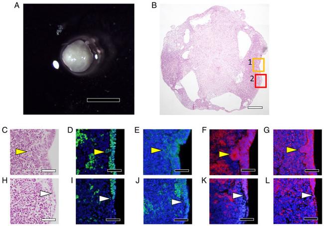 SOX2 Antibody in Immunocytochemistry (ICC/IF)