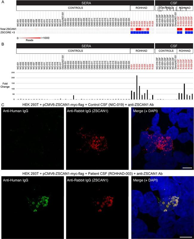 ZSCAN1 Antibody in Immunocytochemistry (ICC/IF)