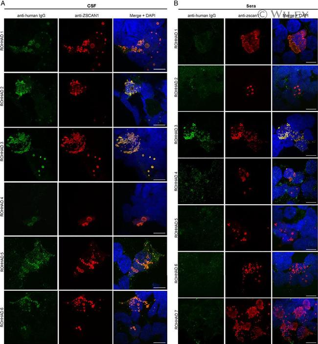 ZSCAN1 Antibody in Immunocytochemistry (ICC/IF)