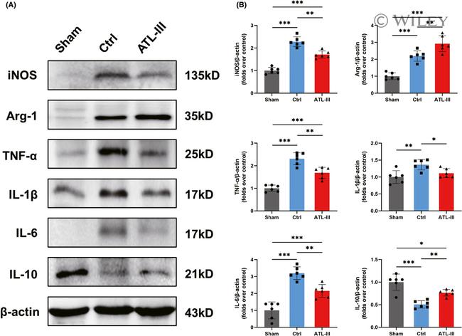 Arginase 1 Antibody in Western Blot (WB)