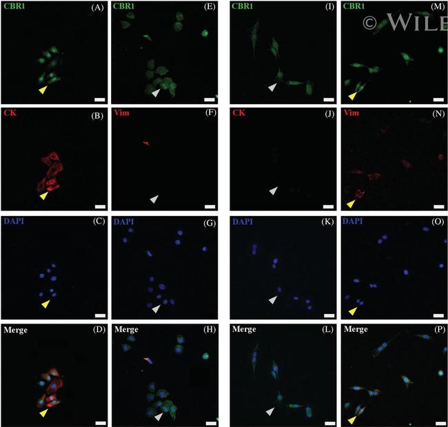 Vimentin Antibody in Immunocytochemistry (ICC/IF)