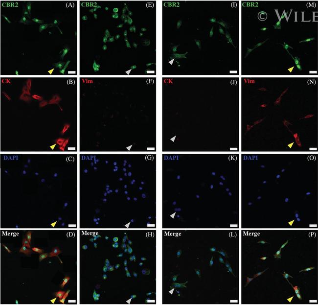 Vimentin Antibody in Immunocytochemistry (ICC/IF)