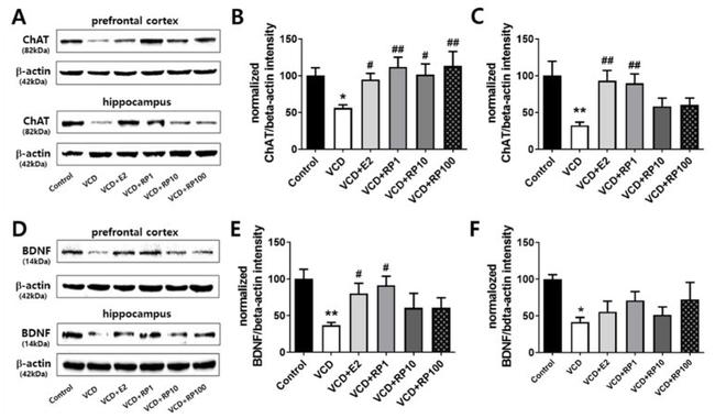 BDNF Antibody in Western Blot (WB)