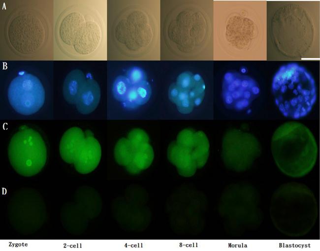 Estrogen Receptor alpha Antibody in Immunocytochemistry (ICC/IF)