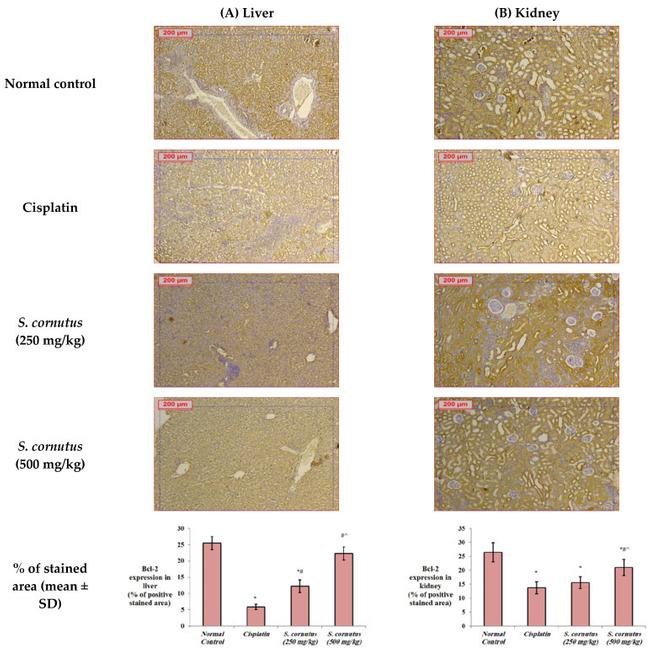 Bcl-2 Antibody in Immunohistochemistry (Paraffin) (IHC (P))