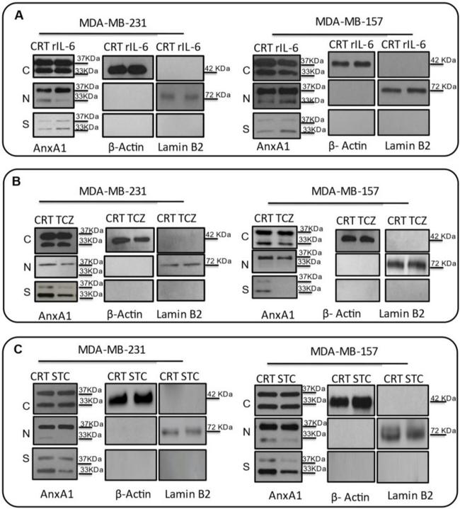 Annexin A1 Antibody in Western Blot (WB)