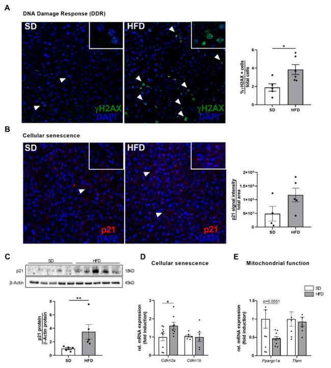 p21 Antibody in Immunohistochemistry (IHC)