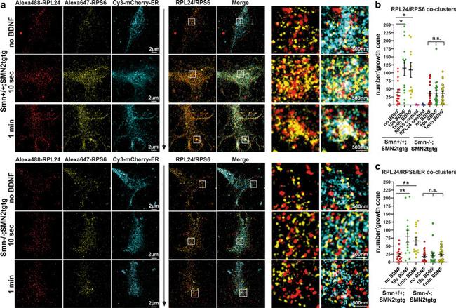 S6 Antibody in Immunocytochemistry (ICC/IF)