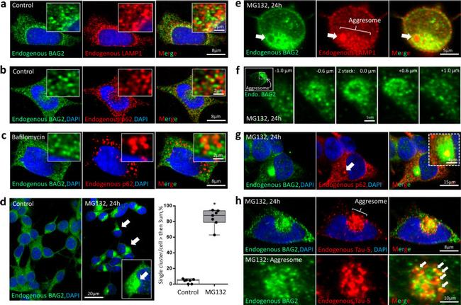 BAG2 Antibody in Immunocytochemistry (ICC/IF)