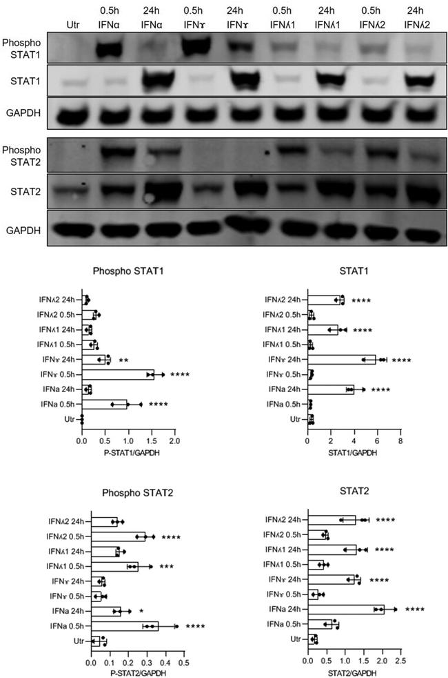 STAT2 Antibody in Western Blot (WB)